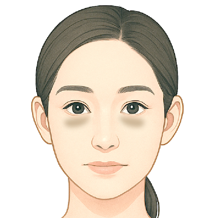 目の下が茶色っぽく見える場合