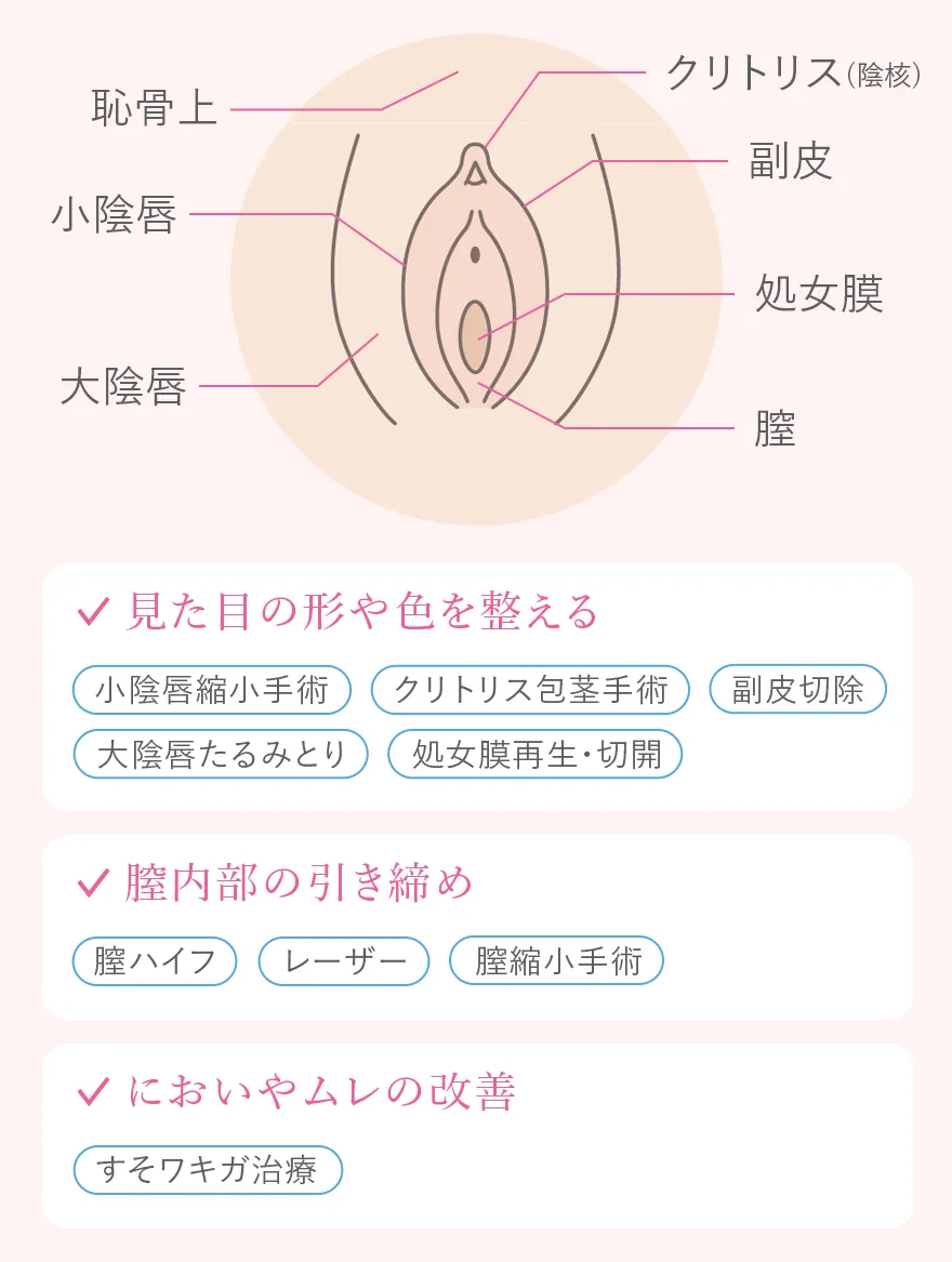 婦人科形成の目的