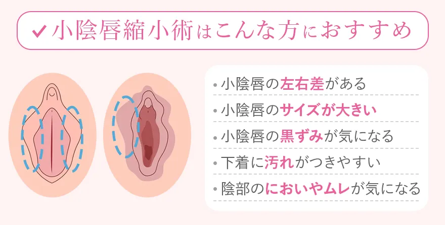 小陰唇縮小術おすすめ