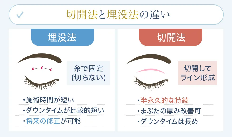 埋没法と切開法の違い