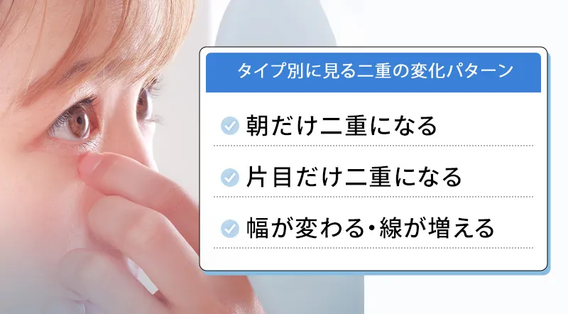 寝不足による二重はどんな状態？症例と特徴を紹介