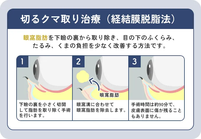 経結膜脱脂の特徴