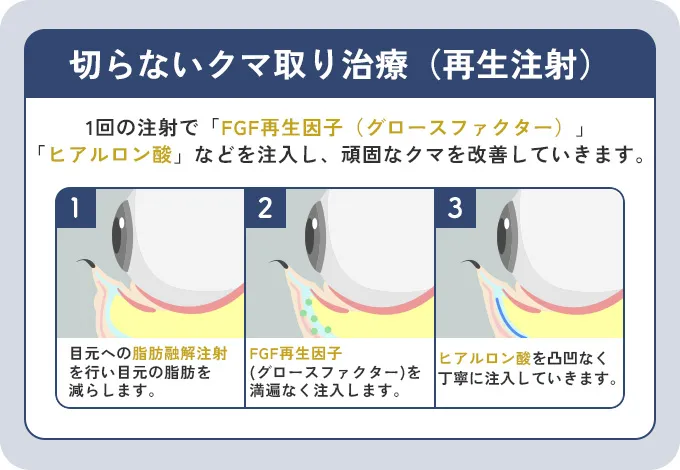 再生注射の特徴
