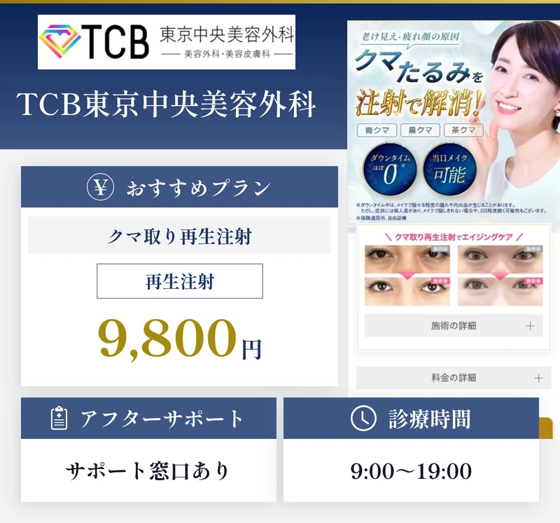 TCB東京中央美容外科