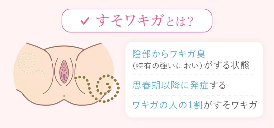 すそワキガのにおいや特徴