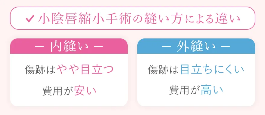 縫い方による違い