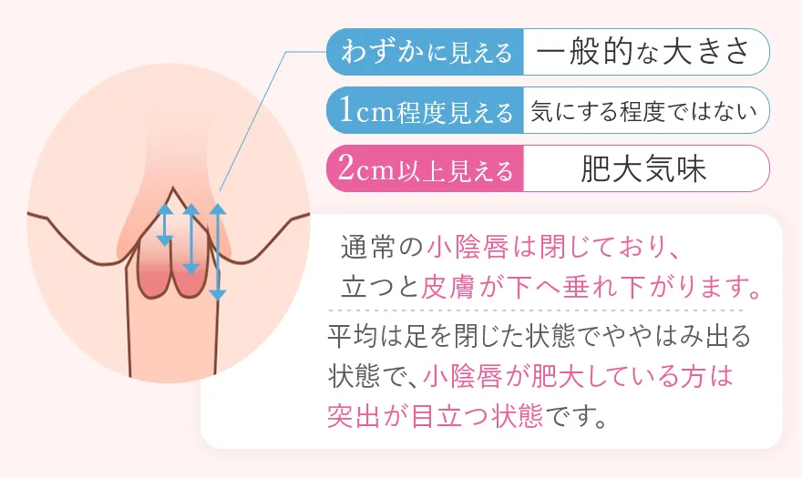 脚を閉じた場合の小陰唇の長さ