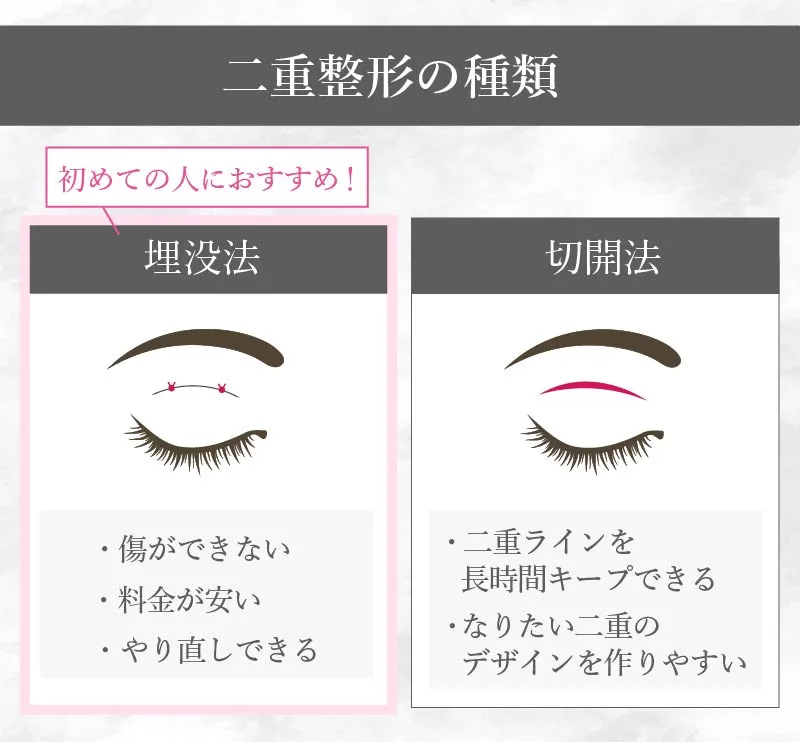 埋没法と切開法