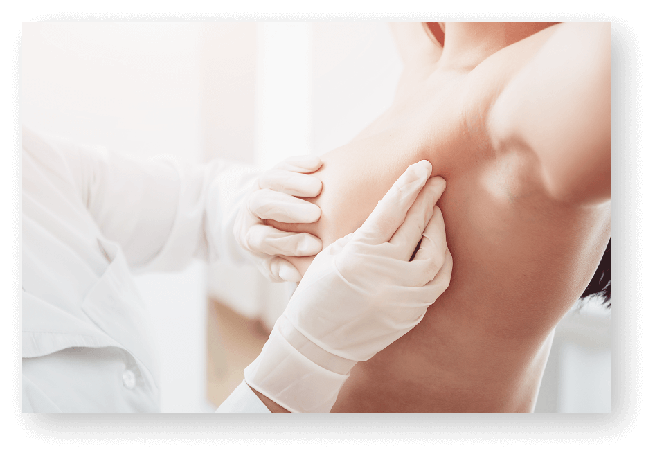 人工乳房＋脂肪注入（ハイブリッド法）