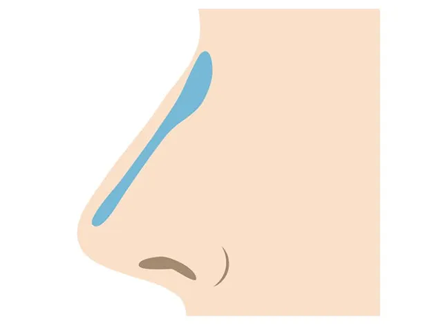 鼻整形メニュー