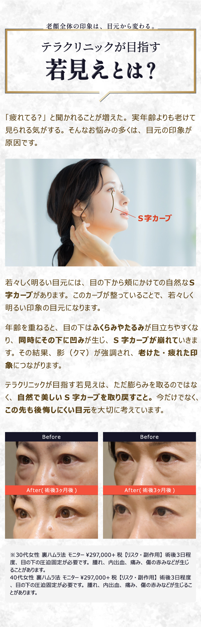 テラクリニックが目指す若見え