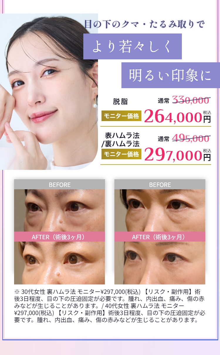 目の下のクマ・たるみ取りでより若々しく明るい印象に