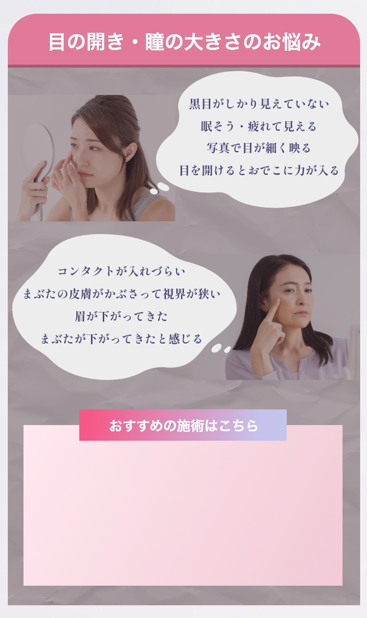 目の開き・瞳の大きさのお悩み