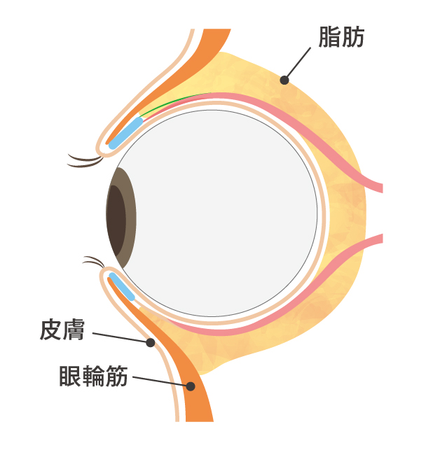 通常の目の下の状態