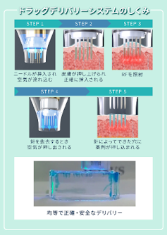 均一に薬剤を浸透させるドラッグデリバリーシステム